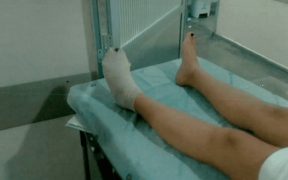 Jovem ferida em elevador será indenizada em cerca R$ 60 mil